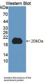 5',3'-Nucleotidase, Cytosolic (NT5C) Antibody