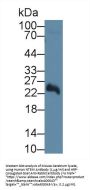 5'-Nucleotidase, Mitochondrial (NT5M) Antibody