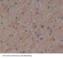 5'-Nucleotidase, Mitochondrial (NT5M) Antibody