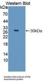 Dipeptidyl Peptidase 3 (DPP3) Antibody