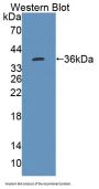 3-Ketoacyl-CoA Thiolase, Mitochondrial (ACAA2) Antibody