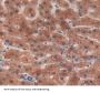 3-Ketoacyl-CoA Thiolase, Mitochondrial (ACAA2) Antibody