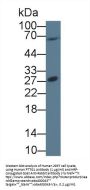 Pituitary Tumor Transforming 1 (PTTG1) Antibody