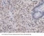 Pituitary Tumor Transforming 1 (PTTG1) Antibody