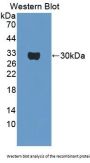 Osteosarcoma Amplified 9 (OS9) Antibody