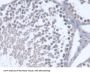 Osteosarcoma Amplified 9 (OS9) Antibody