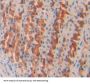 Osteosarcoma Amplified 9 (OS9) Antibody