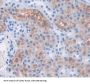 Phenylalanyl tRNA Synthetase 2, Mitochondrial (FARS2) Antibody