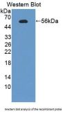 Phenylalanyl tRNA Synthetase 2, Mitochondrial (FARS2) Antibody