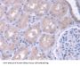 Phenylalanyl tRNA Synthetase 2, Mitochondrial (FARS2) Antibody