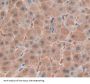 Phenylalanyl tRNA Synthetase 2, Mitochondrial (FARS2) Antibody