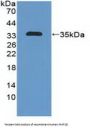 Microtubule Associated Protein 1B (MAP1B) Antibody