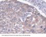 Microtubule Associated Protein 1B (MAP1B) Antibody