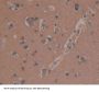 Microtubule Associated Protein 1B (MAP1B) Antibody