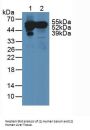 Vitamin D Binding Protein (DBP) Antibody