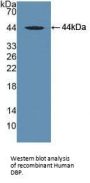 Vitamin D Binding Protein (DBP) Antibody