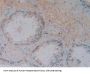Vitamin D Binding Protein (DBP) Antibody