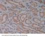Vitamin D Binding Protein (DBP) Antibody