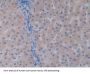Vitamin D Binding Protein (DBP) Antibody