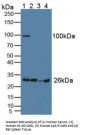 Grancalcin (GCA) Antibody