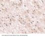 Grancalcin (GCA) Antibody