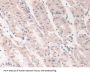 Grancalcin (GCA) Antibody