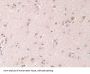 Grancalcin (GCA) Antibody