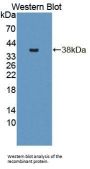Glutamine Fructose-6-Phosphate Transaminase 1 (GFPT1) Antibody