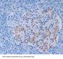 Glutamine Fructose-6-Phosphate Transaminase 1 (GFPT1) Antibody