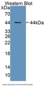 Growth Hormone Releasing Hormone Receptor (GHRHR) Antibody
