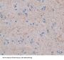 Growth Hormone Releasing Hormone Receptor (GHRHR) Antibody