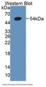 Hexokinase-4 (GCK) Antibody