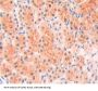 Hexokinase-4 (GCK) Antibody