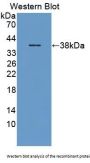 Glycophorin E (GYPE) Antibody