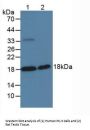 Serine Peptidase Inhibitor Kunitz Type 2 (SPINT2) Antibody