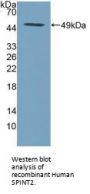 Serine Peptidase Inhibitor Kunitz Type 2 (SPINT2) Antibody