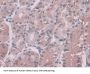Serine Peptidase Inhibitor Kunitz Type 2 (SPINT2) Antibody