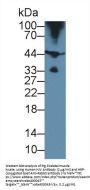Hemojuvelin (HJV) Antibody