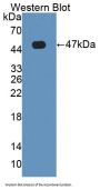 Hemojuvelin (HJV) Antibody