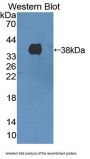 3-Hydroxymethyl-3-Methylglutaryl Coenzyme A Lyase (HMGCL) Antibody