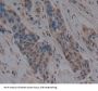 High Mobility Group Protein B3 (HMGB3) Antibody