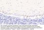 Mannosyl-Oligosaccharide 1,2-Alpha-Mannosidase IA (MAN1A1) Antibody