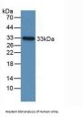 Insulin Like Growth Factor Binding Protein 2 (IGFBP2) Antibody