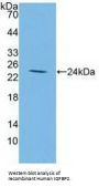 Insulin Like Growth Factor Binding Protein 2 (IGFBP2) Antibody