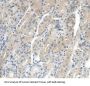 Insulin Like Growth Factor Binding Protein 2 (IGFBP2) Antibody