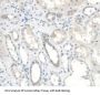 Insulin Like Growth Factor Binding Protein 2 (IGFBP2) Antibody