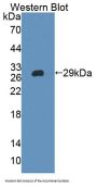 Inter Alpha-Globulin Inhibitor H4 (ITIH4) Antibody
