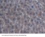 Inter Alpha-Globulin Inhibitor H4 (ITIH4) Antibody