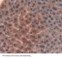 Inter Alpha-Globulin Inhibitor H4 (ITIH4) Antibody