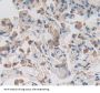 Cyclin Dependent Kinase Inhibitor 2D (CDKN2D) Antibody